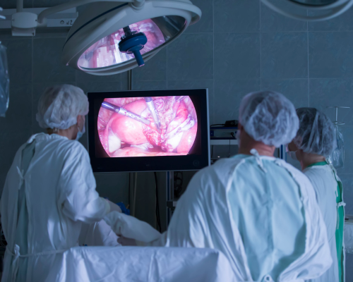 Laparoscopy